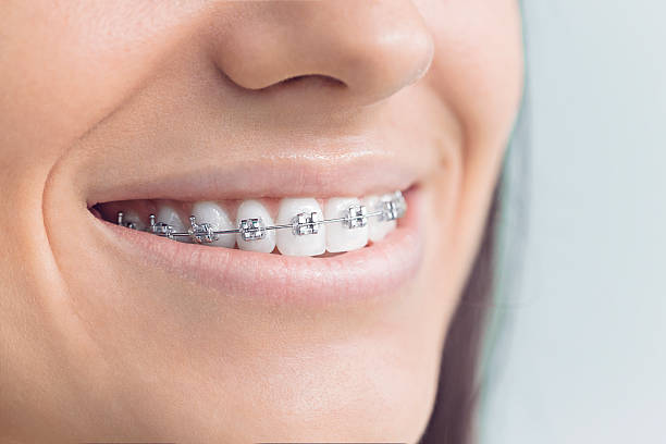 Best Invisalign and Clear Aligners  in Rossmoor, NJ